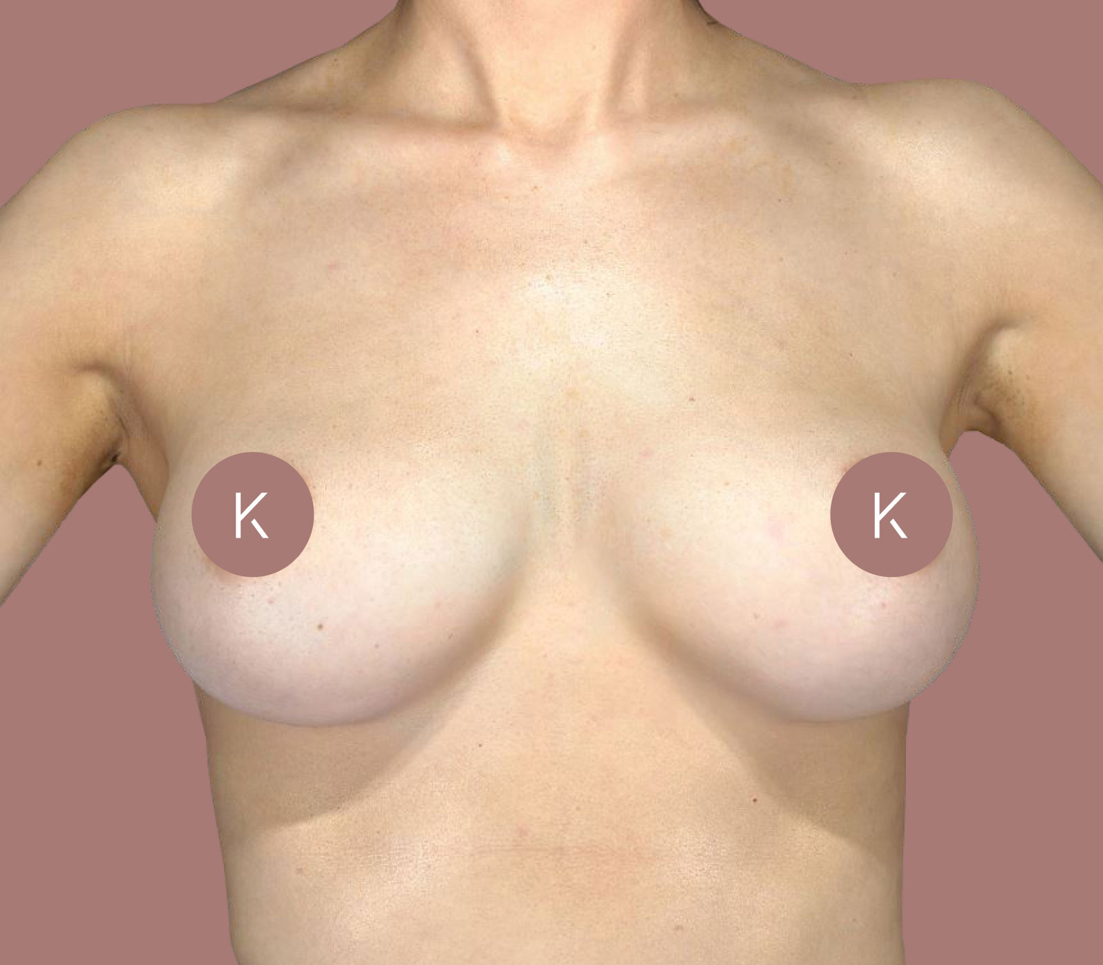 breast augmentations near me